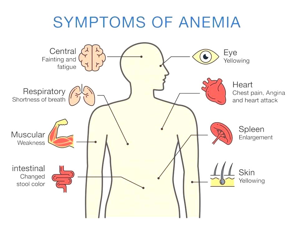 Anemia Testing All You Need To Know About It